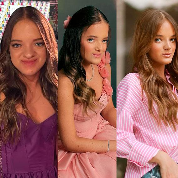 Rafa Justus fez duas cirurgias, três fotos mostram os antes e depois