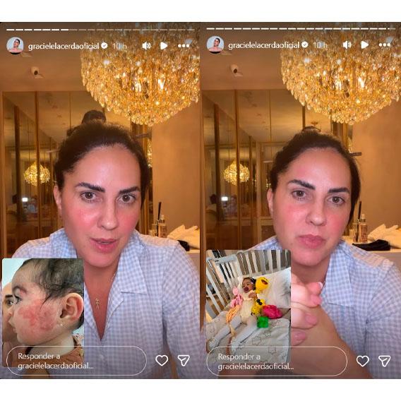 graciele lacerda falou sobre tratamento da filha